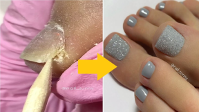 Fresh Toe Nail Art Ideas To Try Right Now | Satisfying Toenail Transformation