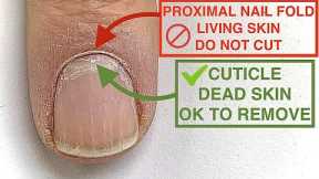 HOW to FIX CUTICLES [YOU'VE BEEN CUTTING THE WRONG THING!] ??