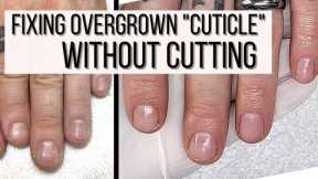 How to FIX Overgrown Cuticles WITHOUT CUTTING.