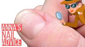 HORRIBLE CUTICLES? THINK AGAIN! This info will change everything! ?