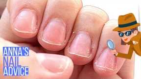 Why Are These Nails Weak? Find Out. [Anna's Nail Advice]