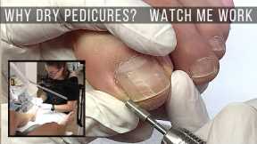 How I Do My Dry Pedicures [Watch Me Work] ?