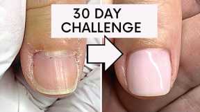 CONTEST TIME!!! WIN PRIZES Overgrown Skin Around The Nails, NOT CUTICLE! challenge  💵  💅