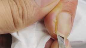 Manicure: Finger nail trim satisfying