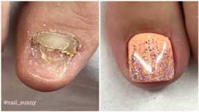 Most Satisfying Pedicure Transformation 😱 best nail polish for toes 2022
