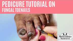 👣How to Pedicure on Thick Dark Big Toenails with Nail Fungus👣