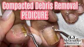 👣Deep Pedicure Cleaning and Compacted Debris Removal👣