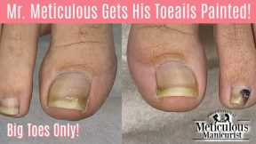 👣Big Toes Only - Ingrown Toenail & Impacted Toenail Pedicure: Relief, Causes and Prevention👣