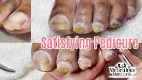 👣Pedicure Tips for Excessive Impacted Cuticle and Yellow Big Toenails👣