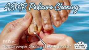 👣ASMR Pedicure Cleaning💆‍♀️Toenail Fungus Cleaning at Home Success👣