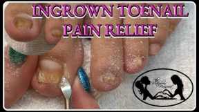 👣 Satisfying Ingrown Toenail Pain Pedicure Tutorial👣