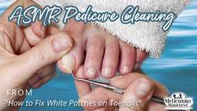 👣ASMR Pedicure Cleaning💆‍♀️How to Fix White Patches on Toenails👣