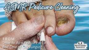👣ASMR Pedicure Cleaning💆‍♀️How to do a Pedicure on a Bad Case of Nail Fungus👣