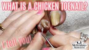 👣What is a Chicken Toe PEDICURE TUTORIAL👣