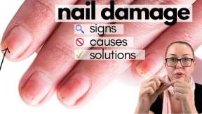 Damaged nails after acrylics, gels or dips? Your next steps  [Nail Professional Explains]