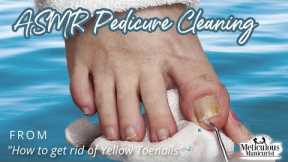 👣ASMR Pedicure Cleaning💆‍♀️How to get rid of Yellow Toenails👣