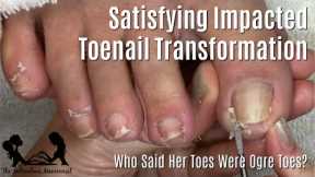👣 Beginners How to Clean Toenails at Home Pedicure Tutorial 👣