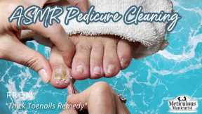 👣ASMR Pedicure Cleaning💆‍♀️Thick Toenails Remedy👣