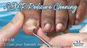 👣ASMR Pedicure Cleaning💆‍♀️3 Clues your Toenails and Feet Need More Care👣