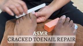 ASMR Cracked Toenail Repair | Pedicure ASMR