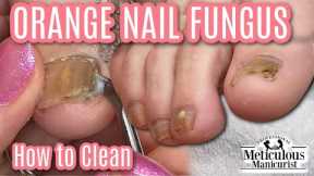 👣Pedicure for Men How to Clean Orange Nail Fungus Off Toenails👣