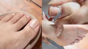 Relaxing DIY ASMR Pedicure Callus Feet | Water Sounds