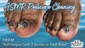 👣ASMR Pedicure Cleaning💆‍♀️Nail Fungus Cure: 3 Secrets to Total Relief👣