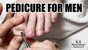 👣Pedicure for Men - Repair Damaged Toenails👣
