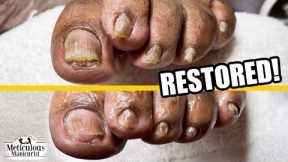 👣PEDICURE NEAR ME & Reverse Unwanted Toenail Appearance with Conservative Care👣