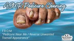 👣ASMR Pedicure Cleaning💆‍♀️Pedicure Near me & Reverse Unwanted Toenail Appearance Conservative Care