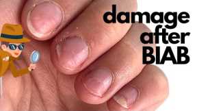 How to correct damage after BIAB? (Builder in a bottle) [Anna's Nail Advice]