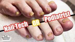 👣 Nail Technician or Podiatrist: A Comparison in Feet and Foot Care Approaches 👣