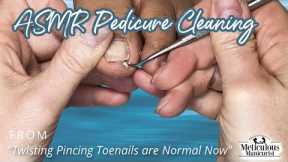 👣ASMR Pedicure Cleaning💆‍♀️Twisting Pincing Toenails are Normal Now👣