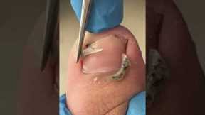 Satisfying pedicure video! #pedicure
