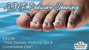 👣ASMR Pedicure Cleaning💆‍♀️Thick Toenails: Pedicure Tips and Conservative Care👣