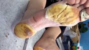 Pedicure Master Treats Feet Safely【Foot Scalpel】