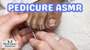 👣ASMR Pedicure Cleaning💆‍♀️Twisting, Turning, and Curling Toenails Pedicure Tutorial👣