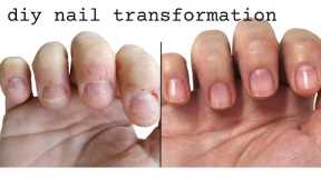 From biting nails to beautiful (and healthy!) nails!
