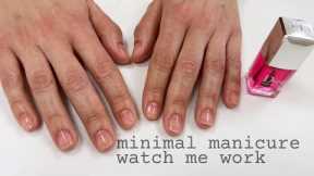 You won't believe how her nails looked before! [Minimal manicure, watch me work]