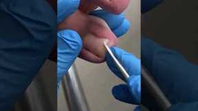 Satisfying pedicure video!  #shorts #manicuresvideos #pedicure #ASMR