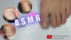 asmr nail | asmr pedicure cleaning