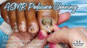 👣ASMR Pedicure Cleaning💆‍♀️Diabetic Pedicure: Toenail Damage or Nail Fungus?👣