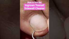 How to use the Ingrown Toenail Sidewall Cleaner #ingrowntoenail #pedicure #meticulousmanicurist