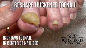 Pedicure Tutorial: Stop Hiding Your Nails Optical Illusion for Thick Toenails