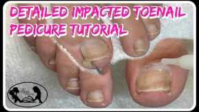 👣 Satisfying Impacted Toenail Cleaning Pedicure Tutorial Detailed Instruction  👣⭐