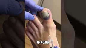 Ouch! Numbing A Toe: A Quick Fix