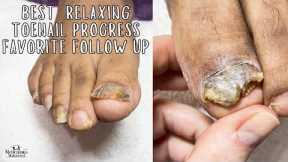 Best Toe nail Improvement and Relaxing Pedicure