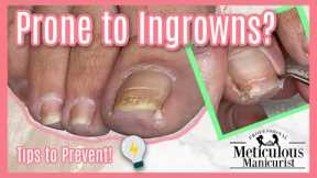 How to Prevent Ingrown Toenails in a Relaxing ASMR Pedicure