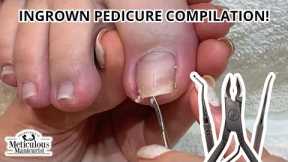 This Painful Ingrown Toenail was Fixed with Pedicure Tools