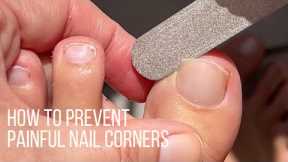 How to prevent painful nails by rounding off nail corners w/ultra thin diamond file